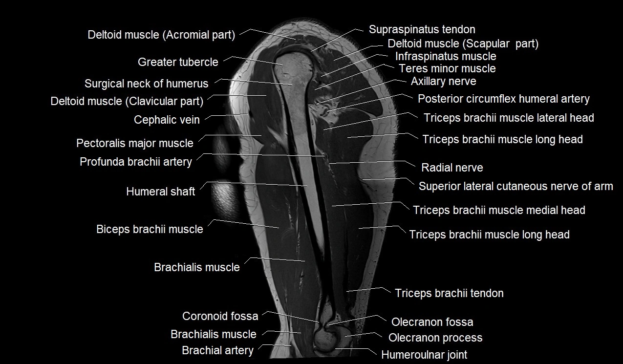 Upper arm (humerus ) saittal cross sectional anatomy 3T image 16.webp